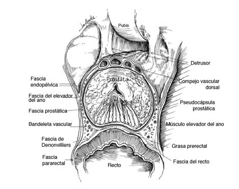 Anatomía quirúrgica de la prostatectomía radical