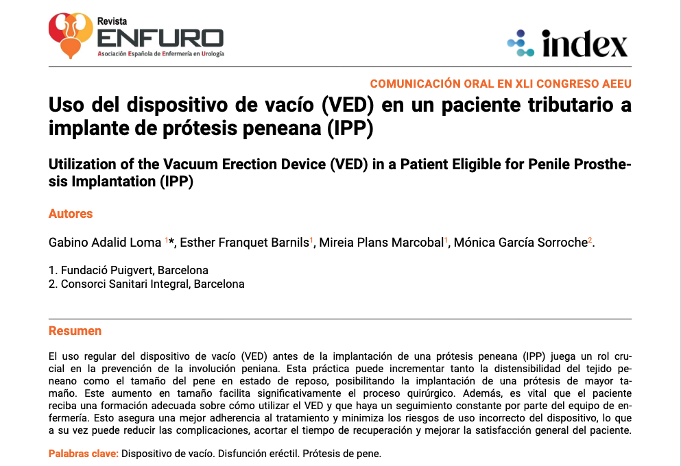 Uso del dispositivo del Vacuum